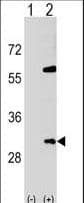 SNF8 / EAP30 Antibody (aa37-65)