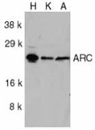 Polyclonal Rabbit anti-Human NOL3 / ARC Antibody (IHC, WB)
