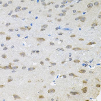 Polyclonal Rabbit anti-Human TRPC1 Antibody (IHC, WB)