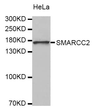 Polyclonal Rabbit anti-Human SMARCC2 Antibody (IHC, WB)