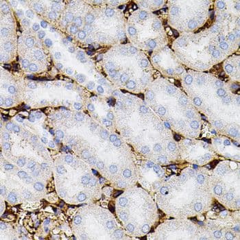 MMP9 / Gelatinase B Antibody