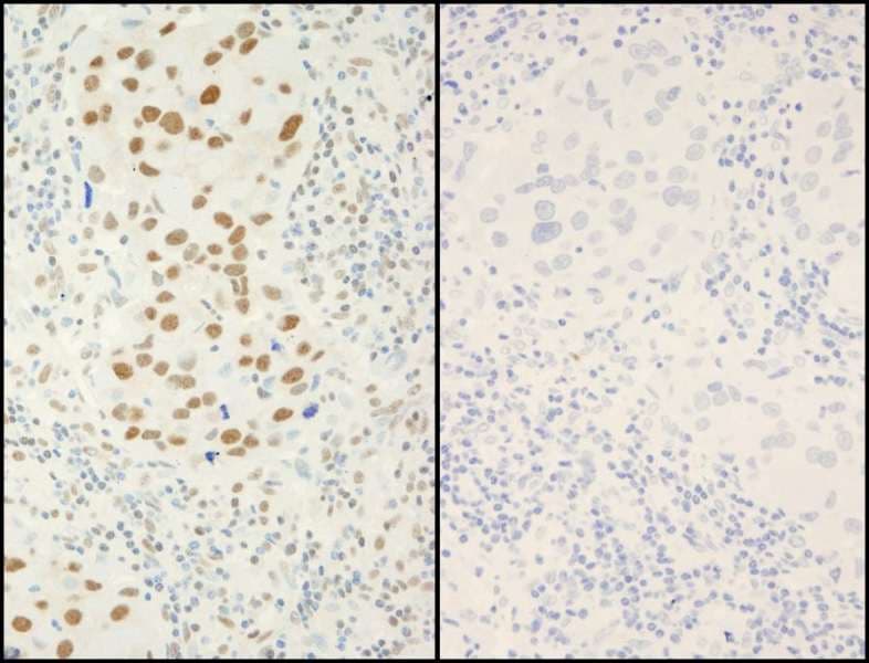 Polyclonal Rabbit anti-Human XRCC1 Antibody (phospho-Ser518 / phospho-Thr519/523, IHC, IF)
