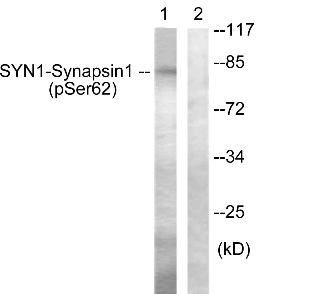 SYN1 / Synapsin 1 Antibody (phospho-Ser62)