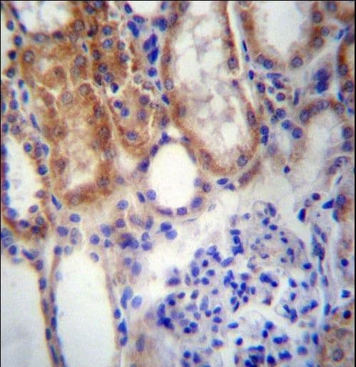Polyclonal Rabbit anti-Human SUSD2 Antibody (aa716-745, IHC, WB)