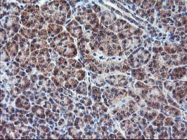 Monoclonal Mouse anti-Human PPP1R15A / GADD34 Antibody (clone OTI4F1, IHC, IF, WB)