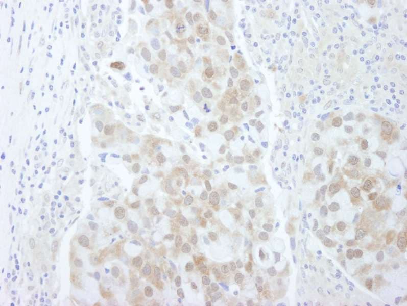 EIF4EBP1 / 4EBP1 Antibody (aa75-C-term)