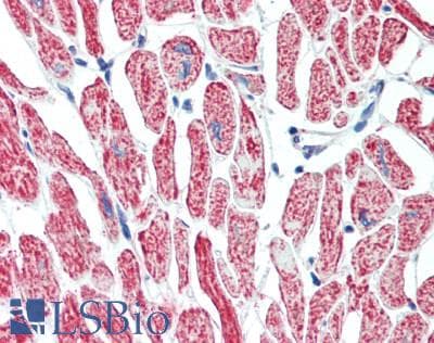 IHC-plus™ Polyclonal Rabbit anti-Human NDUFA4L2 Antibody (74-87 aa, C-terminal, IHC, WB)