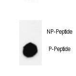 KDM4B / JMJD2B Antibody (phospho-Ser566)