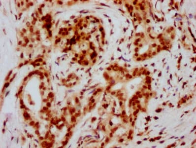 HIST1H2BN Antibody