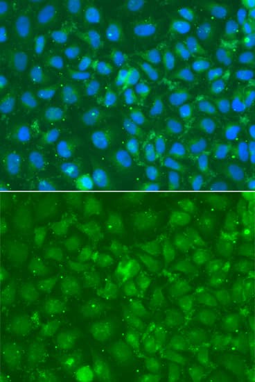 IHC-plus™ Polyclonal Rabbit anti-Human SRGN / Serglycin Antibody (IHC, IF, WB)