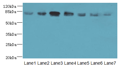 Polyclonal Rabbit anti-Human CLGN / Calmegin Antibody (IHC, WB)