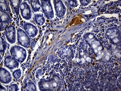 Monoclonal Mouse anti-Human CD3E Antibody (clone UMAB54, Carrier-free, IHC, IF, WB)