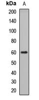 IHC-plus™ GBA / Glucosidase Beta Acid Antibody