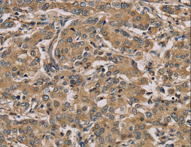 MYL3 Antibody