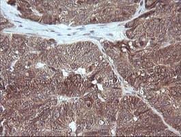 MAP2K3 / MEK3 / MKK3 Antibody (clone OTI6F8)