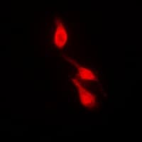 MAPK14 / p38 Antibody (phospho-Tyr182)