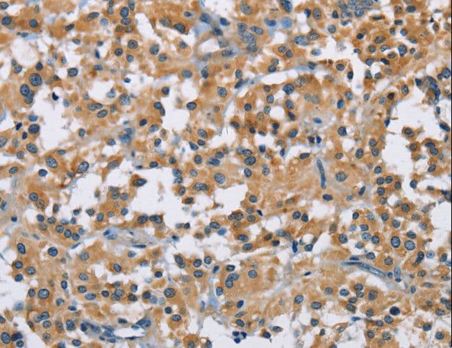 Polyclonal Rabbit anti-Human DNMT3A Antibody (IHC)