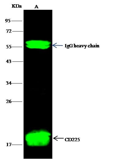Monoclonal Rabbit anti-Human CD225 / IFITM1 Antibody (clone 021, Preservative Free, IF, WB)