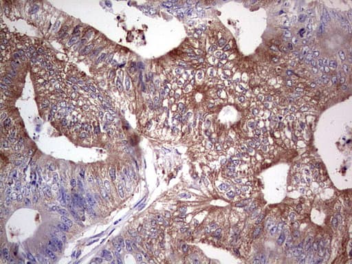 Monoclonal Mouse anti-Human PKM2 Antibody (clone 1F12, IHC, WB)