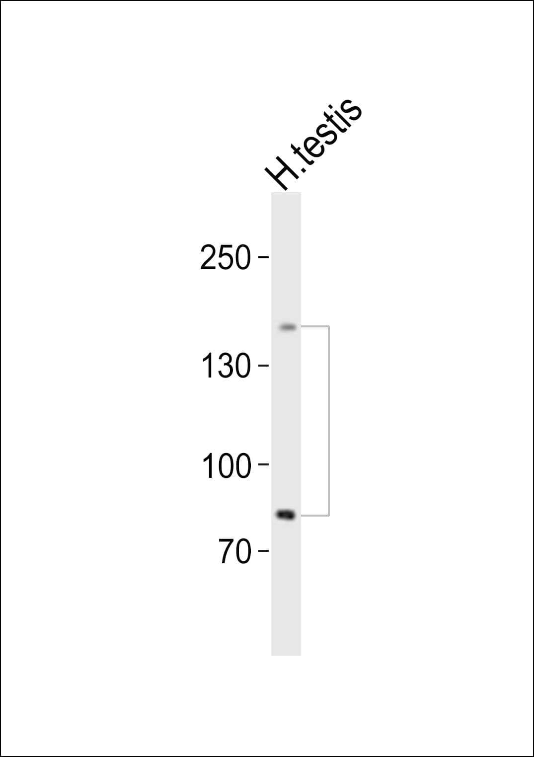 SALL4 Antibody (aa1035-1069)