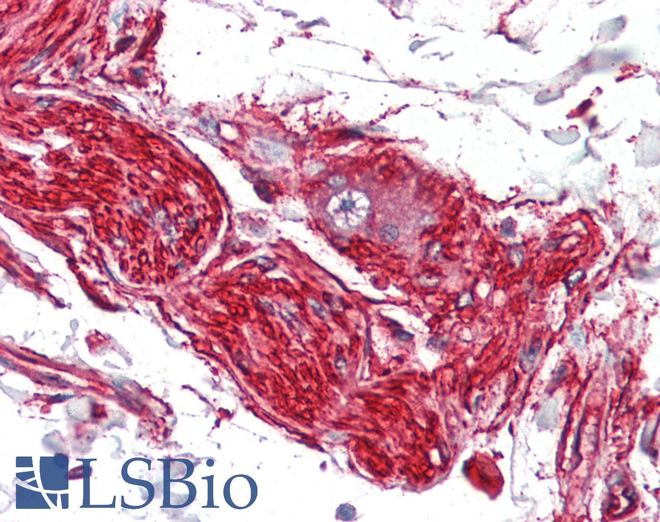 IHC-plus™ S100A10 Antibody (clone 4E7E10)