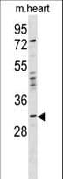 Polyclonal Rabbit anti-Human OTP Antibody (aa88-115, WB)