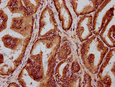 HLCS / HCS Antibody