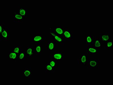HIST1H4I Antibody