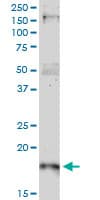 CDKN1A / WAF1 / p21 Antibody (clone 2F1)