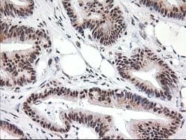 MGLL / Monoacylglycerol Lipase Antibody (clone OTI2B11)