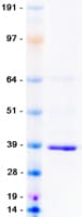 Human MCU / CCDC109A Protein (Recombinant Myc-DDK (Flag))