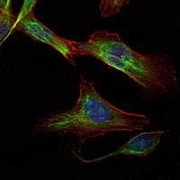 RICTOR Antibody (clone 7B3)