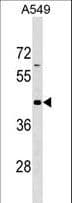 GPR62 Antibody (aa61-87)
