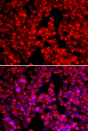 IHC-plus™ MTTP / MTP Antibody