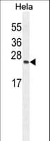 TIMP4 Antibody (aa48-74)