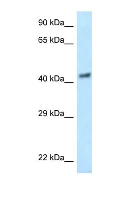 EIF3S5 / EIF3F Antibody (aa97-146)