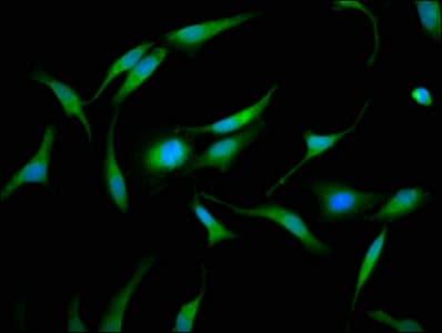 Polyclonal Rabbit anti-Human GMDS / GMD Antibody (IHC, IF)