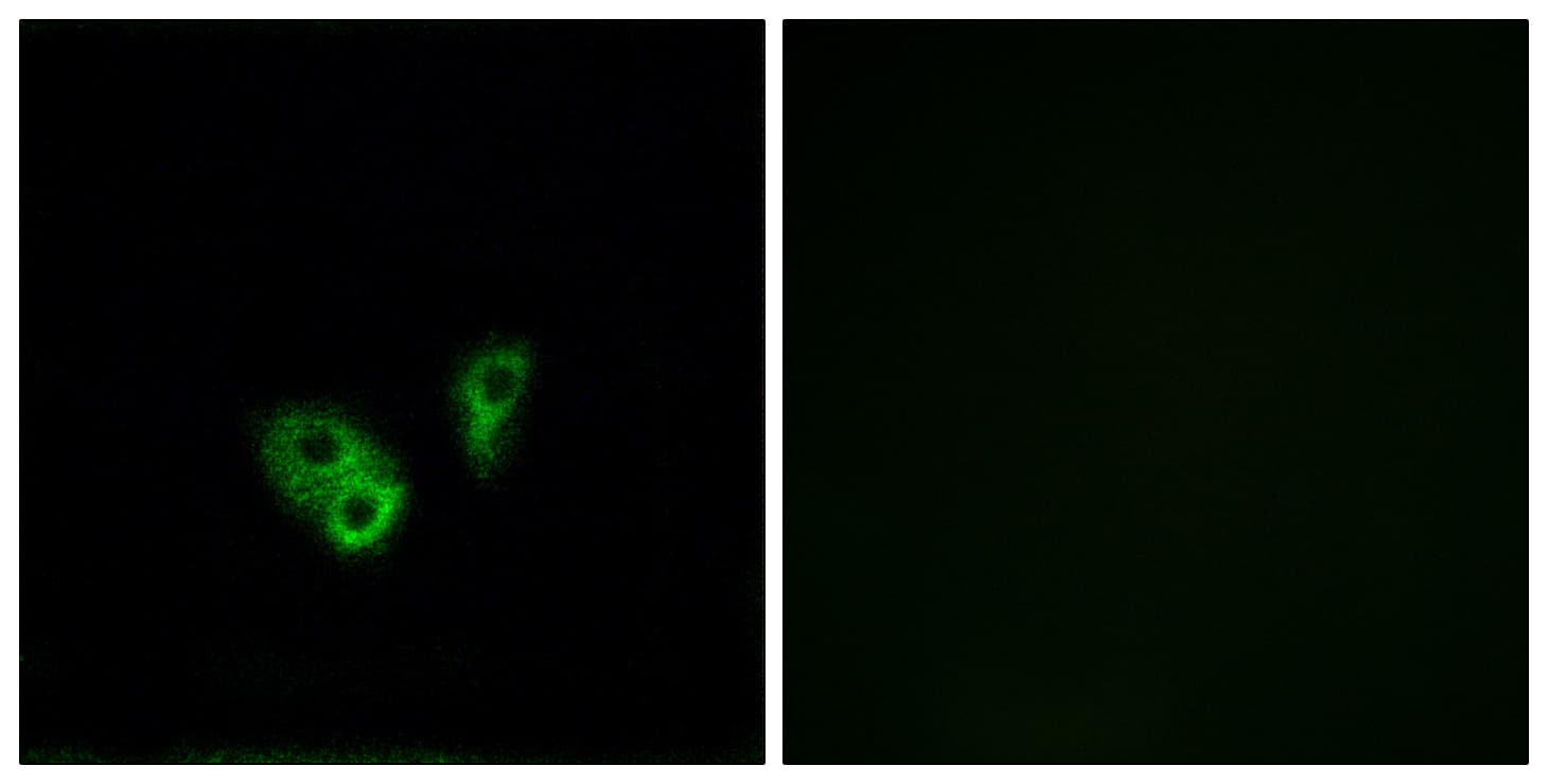 CNGA2 Antibody (aa391-440)