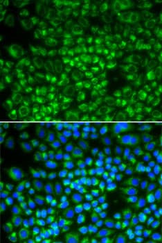 IHC-plus™ SHMT / SHMT2 Antibody