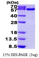 Human TRXR1 / TXNRD1 Protein (Recombinant His)