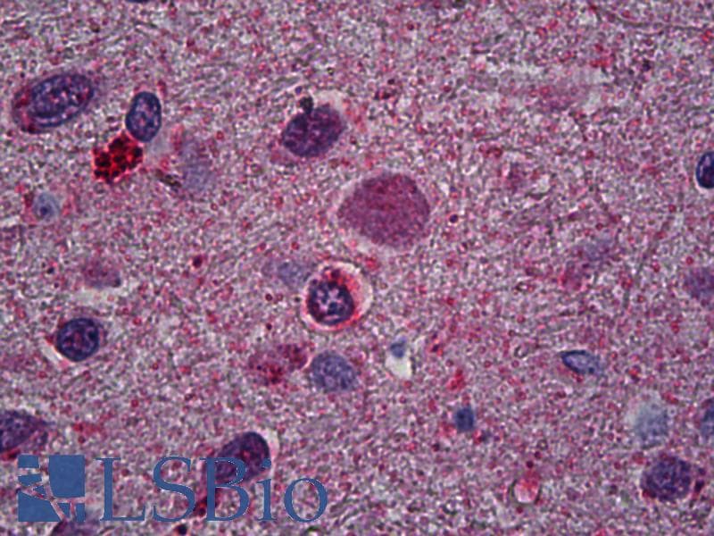 IHC-plus™ OLIG2 Antibody (clone 3C9)