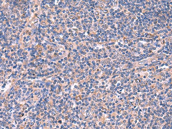 Polyclonal Rabbit anti-Human MPP1 Antibody (IHC)