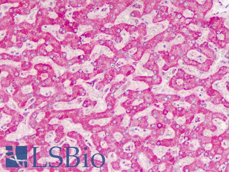 IHC-plus™ Polyclonal Rabbit anti-Human Sprouty 4 / SPRY4 Antibody (aa270-301, IHC, WB)