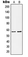 KCNA1 / Kv1.1 Antibody (Internal)