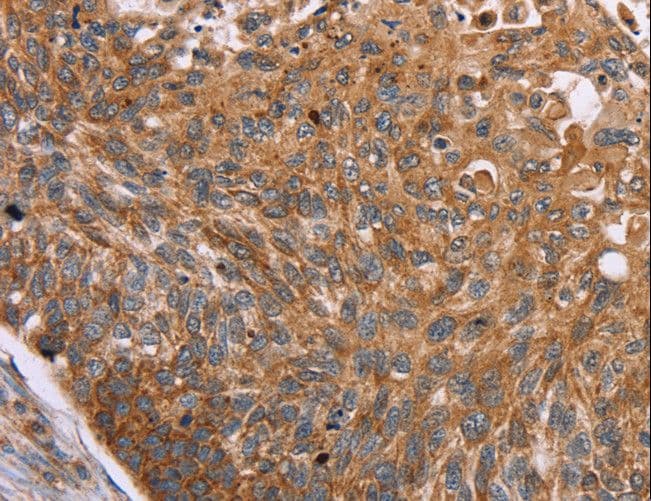 PMPCB / MPP11 Antibody