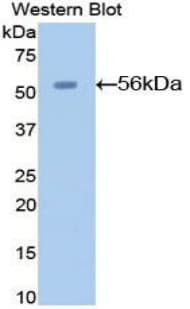 AGT / Angiotensinogen Antibody (aa23-477)