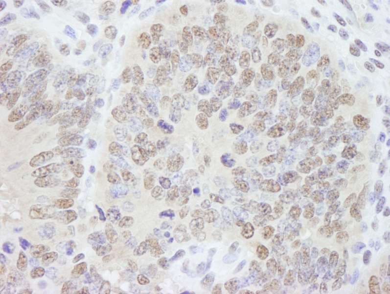 AKAP8 / AKAP95 Antibody (aa642-C-term)