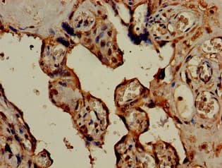 HSD3B1 Antibody