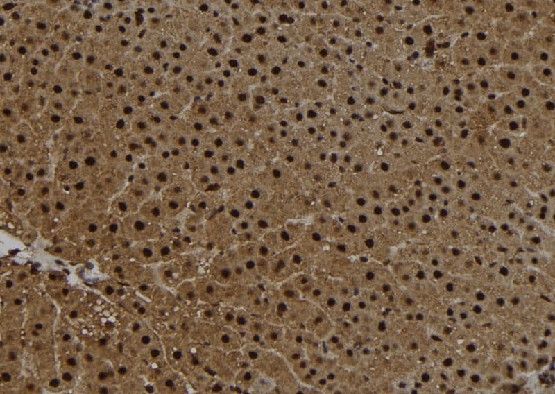CETN2 / Centrin 2 Antibody