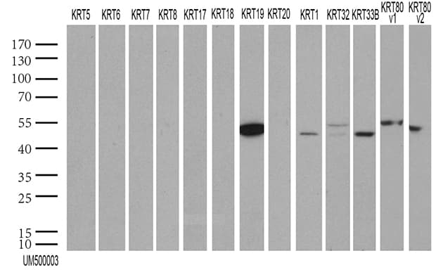 KRT19 / CK19 / Cytokeratin 19 Antibody (aa240-390, clone UMAB3, Carrier-free)
